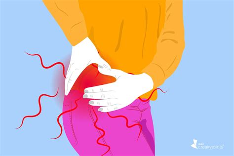 Arthritic Hip Pain Causes at Jake Congreve blog