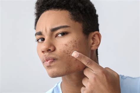 Medical Grade Skincare Products for Acne-Prone Skin | DermFx