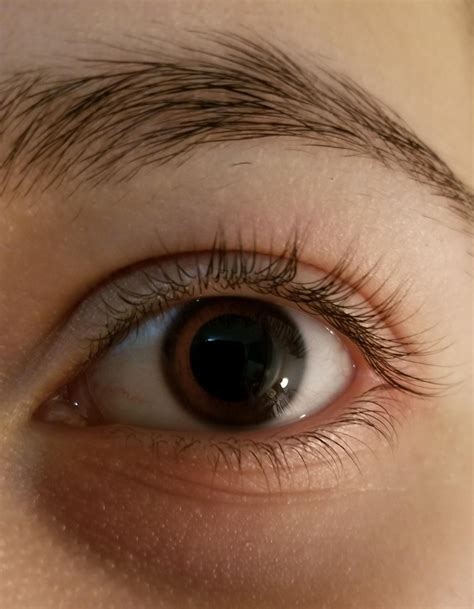 Eyes Dilated Lasts How Long at Bridget Huizenga blog