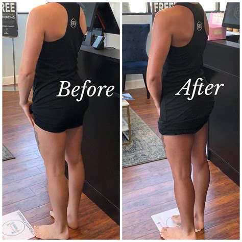 Body - What do before/after spray tan pictures show you? A. How amazing