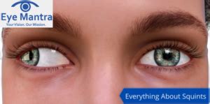 Squint or Strabismus- Causes, Exercises, Treatment, Symptoms