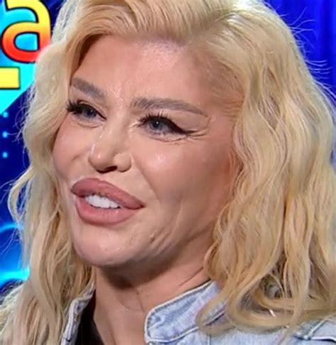 Loredana Groza A Spus Tot Adevărul Despre Operațiile Estetice. Ce Face ...