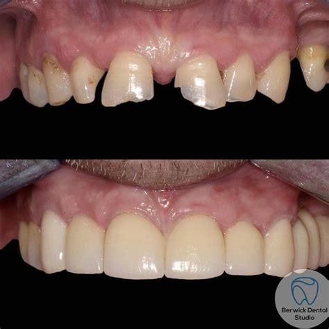 Souirensu: The Before & After Photos Speak for Themselves! - mx0lg94
