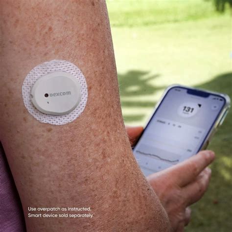 dexcom  sensor pack