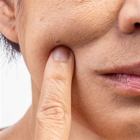 Want To Lift Sagging Skin? A Skincare Expert Shares The 5 Game-Changing ...