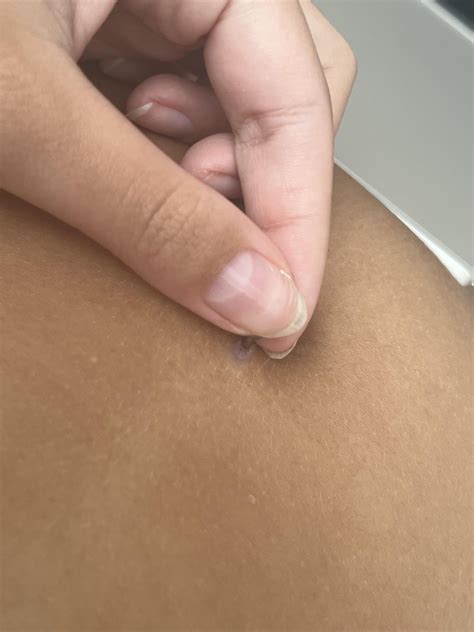 why does my belly piercing look like this under the ball : r/piercing