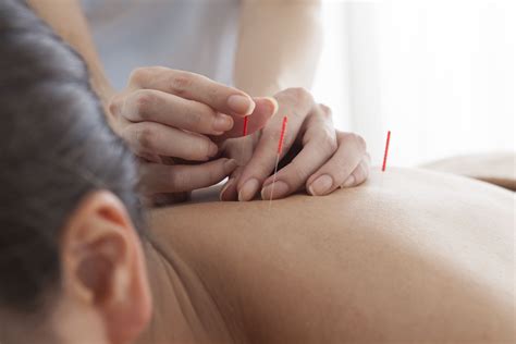 Texas Acupuncture: Read Reviews and Book Classes on ClassPass