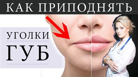 Как приподнять уголки губ / что лучше - филлер/ботокс - YouTube