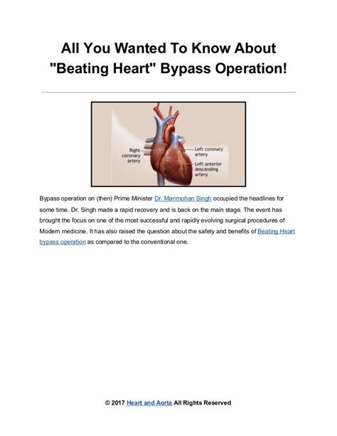 All About Beating Heart Bypass Surgery