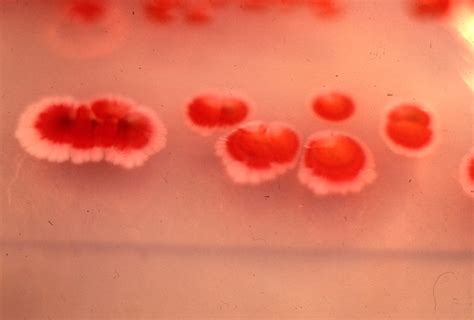 serratia marcescens letty pham