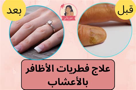 حورياتي في الصحة والجمال