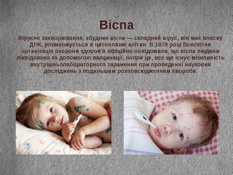 "Вірус віспи" - презентація з медицини