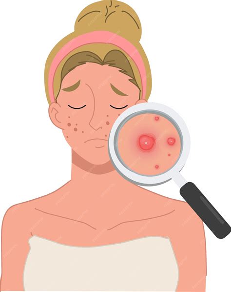 Premium Vector | Medical Concept Hormonal Changes and Skin Conditions