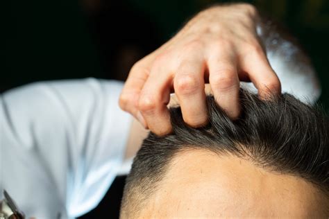 cara mengatasi rambut rontok pria 30