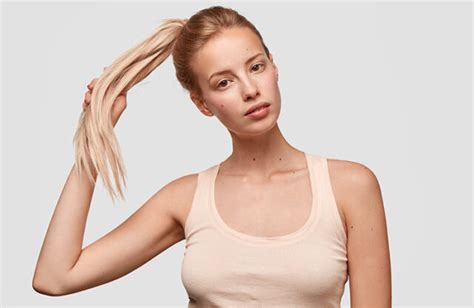 Say Goodbye to Dandruff: Your Guide to Flawless Hair - The Fashiongton Post