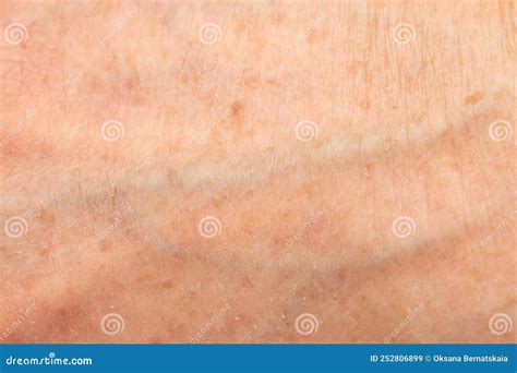 Veins on the Skin of the Hands Stock Image - Image of treatment, blood: 252806899