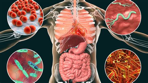 Las infecciones intestinales más comunes