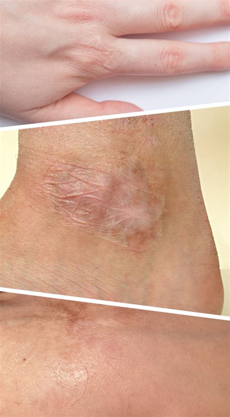 Alana Cho Leak: The Lasting Scars – Long-Term Effects Examined - 4u65tcy