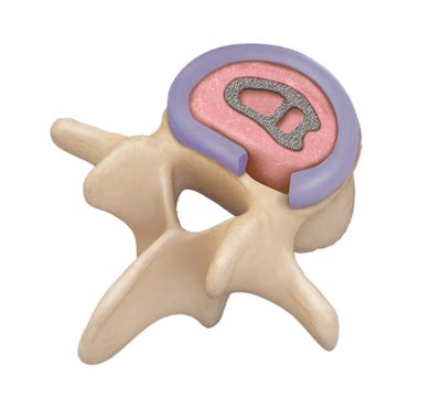 arthrex allograft bone