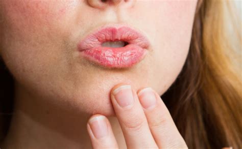 ИМАТЕ СУВА УСТА?-ксеростомијата е честа појава - Panacea.mk