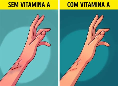 A Falta De Vitamina A - 7 Sinais que indicam que há uma deficiência de vitamina A no corpo