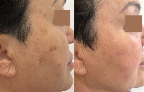 «Ageless Esthetic Center» Ціни, Відгуки - косметологічний центр в ...