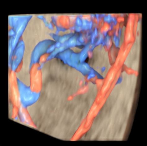 Fetal Echocardiography | FDCAZ