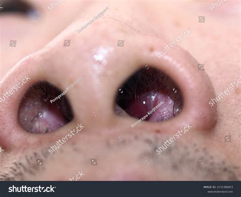 asian nasal passages images stock  vectors shutterstock
