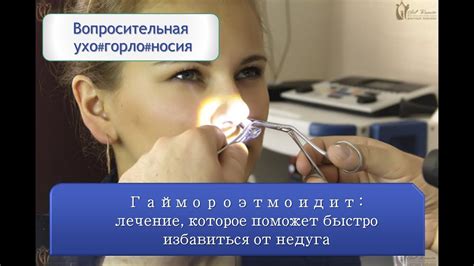 Гаймороэтмоидит: лечение, которое поможет быстро избавиться от недуга ...