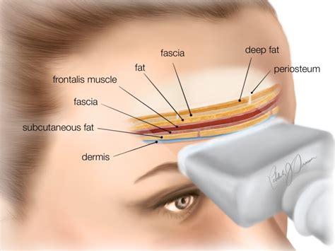 Academy anatomy forehead – Cutaneous