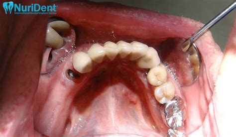 7 – Dr Nuri