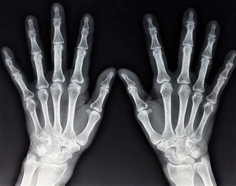 Снимок рентгена | Radiology, X ray, Human muscle anatomy