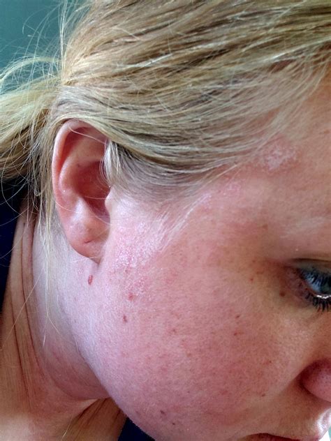 woke up face swollen 5