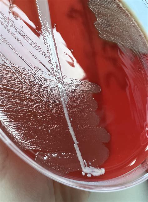 Streptococcus pneumoniae are lancet-shaped, gram-positive, facultative ...