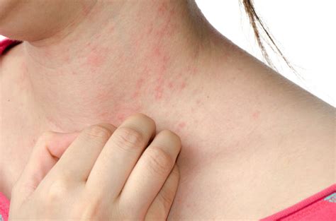 Skin Rash: 10 Causes of Skin Rashes