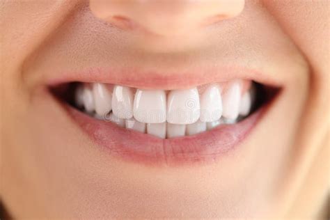 Close-up of Healthy Smooth White Teeth Smile. Stock Photo - Image of ...