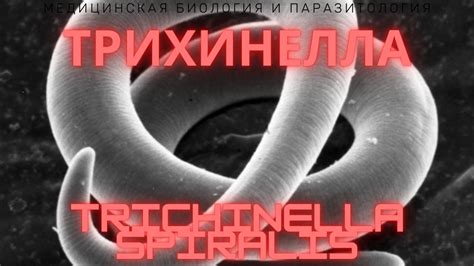 Трихинеллез – симптомы у человека и их фото