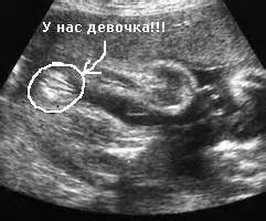 30 неделя беременности. Тридцатая неделя беременности