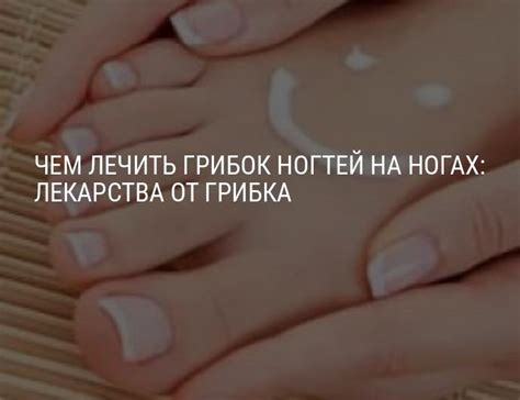 Чем лечить грибок ногтей на ногах: эффективные лекарства от грибка ногтей