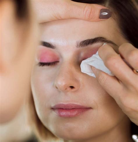 Eyebag Removal Malaysia | Eyebag Treatment - Klinik Nur Raisha