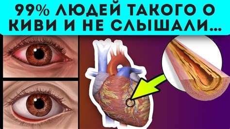 Открыт Неожиданный Целебный Эффект! Поэтому киви скупают тоннами! - YouTube