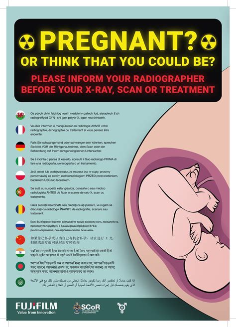 Pregnancy and radiation poster for patients | SoR