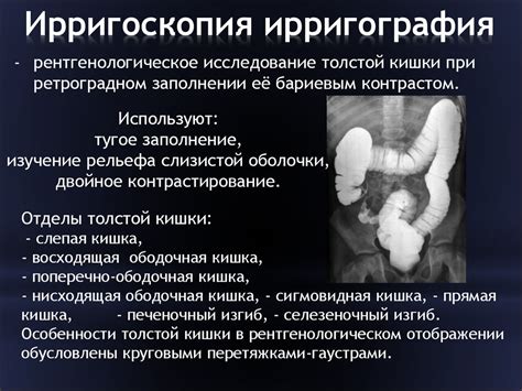 Ирригоскопия кишечника: что это такое, как проводится процедура ...