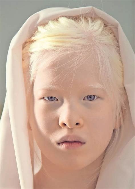 What Color Eyes Do Albino Humans Have - Etheridge Larry