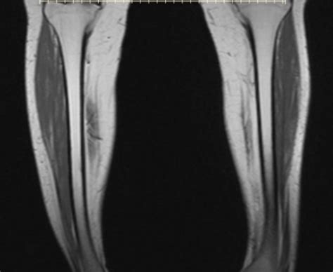 mri  leg mediphany