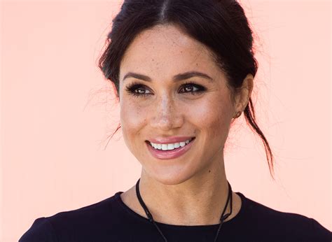 You Won't BELIEVE What Happened After Meghan's Mole Tweet! Image 5
