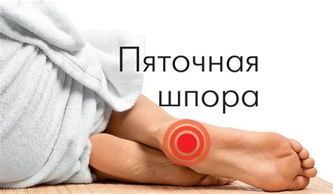 Как избавиться от пяточной шпоры всего за несколько дней? - Упражнения ...
