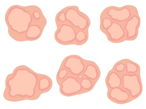 Erythema Marginatum in Skin Illustration Graphic by PurMoon · Creative
