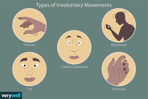 Involuntary Romance - Involuntary Leg Shaking