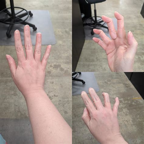 I am double jointed! First photo is normal, other photos from different